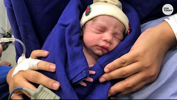 Forum on this topic: First Baby from a Uterus Transplant in , first-baby-from-a-uterus-transplant-in/ Forum on this topic: First Baby from a Uterus Transplant in , first-baby-from-a-uterus-transplant-in/