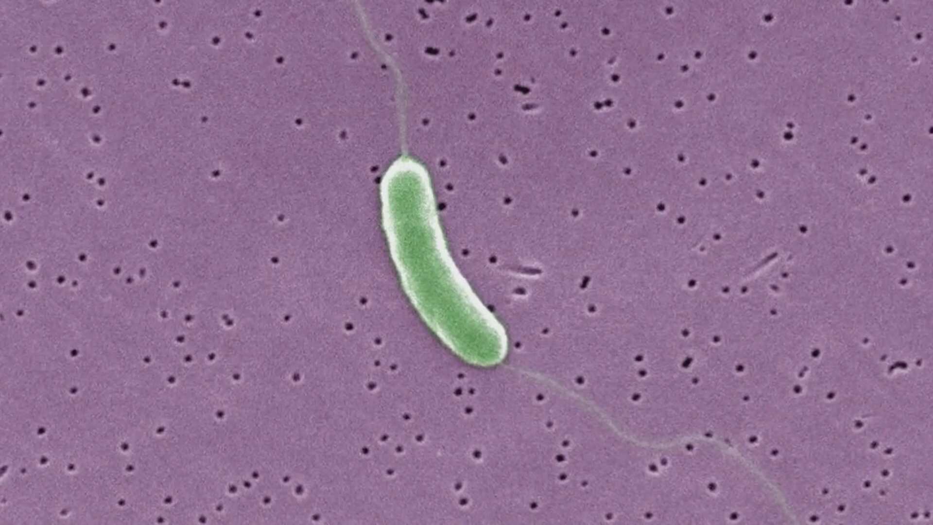 'Flesh-eating' bacteria kills 7 in Gulf Coast states. What to know about Vibrio vulnificus.