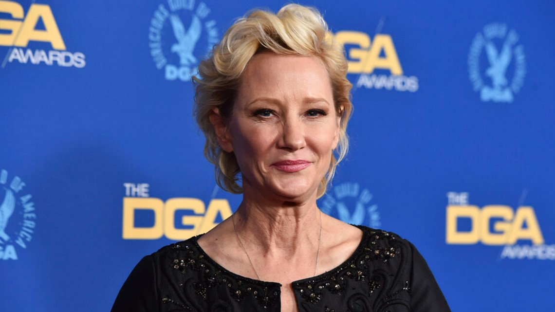 Anne Heche mengalami cedera otak parah, diperkirakan tidak akan selamat dari kecelakaan