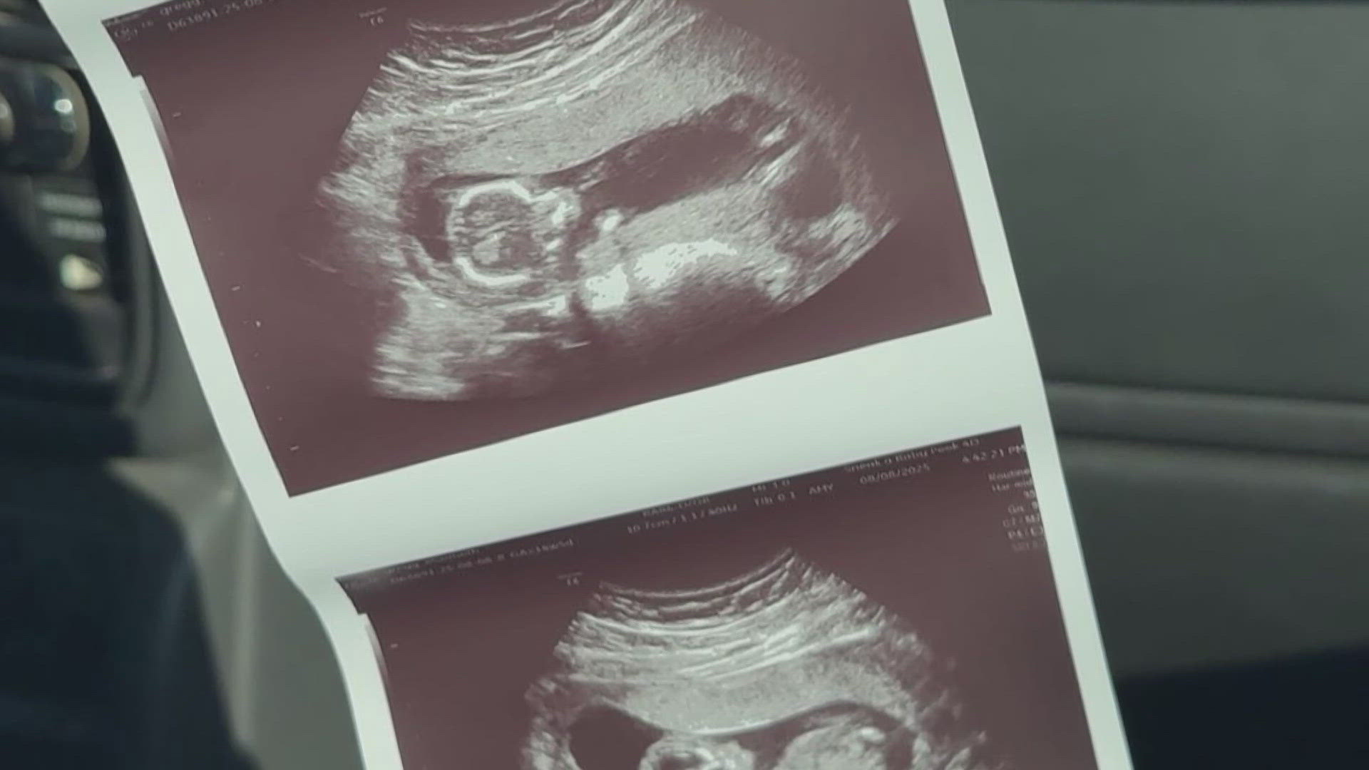 A pregnant Valley woman chose to delay chemotherapy treatment for breast cancer in an effort to protect her unborn baby.