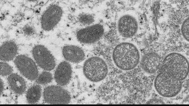 El ADHS está preparado para la Viruela del mono (Monkeypox); no hay nada como el COVID-19