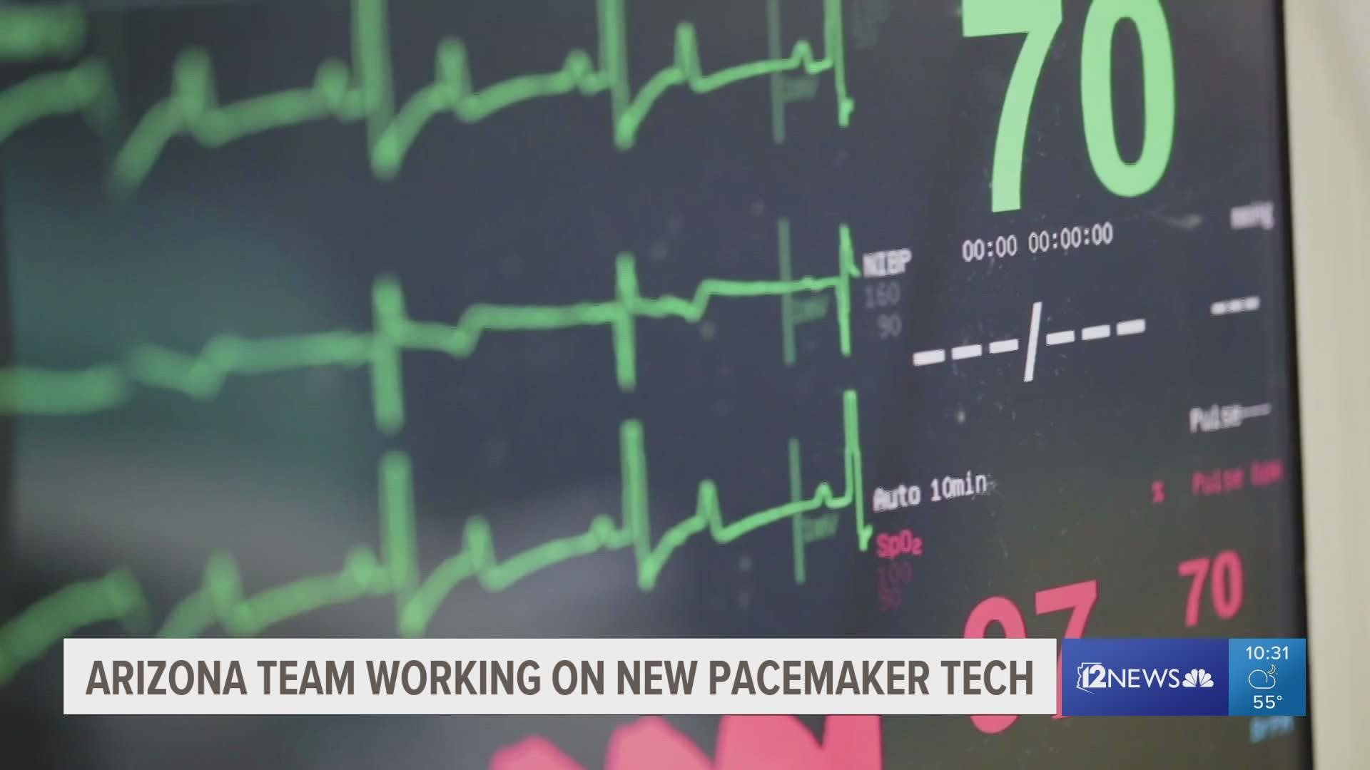 The pacemaker hasn't been tested in human trials but shows promise, researchers say.