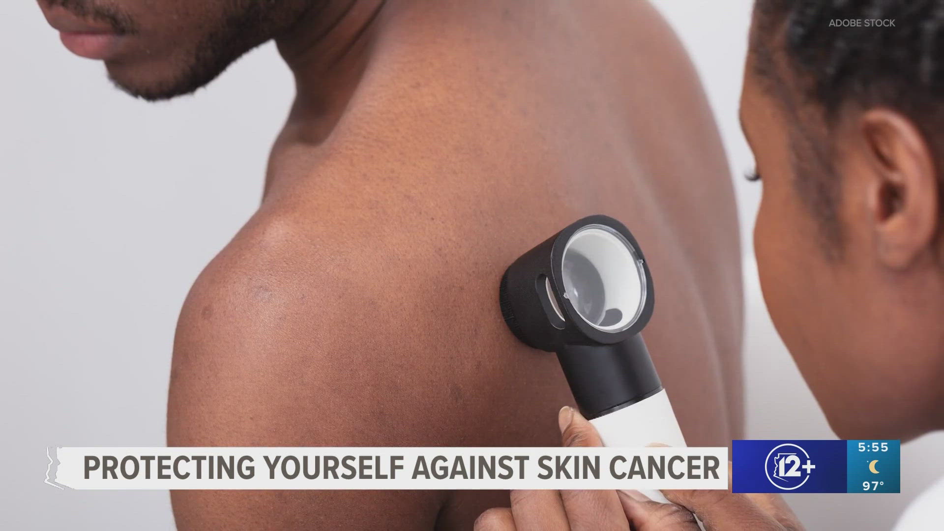 It's a perpetual myth that people with darker skin tones cannot get skin cancer. They can, and it can be more fatal for them, experts say.