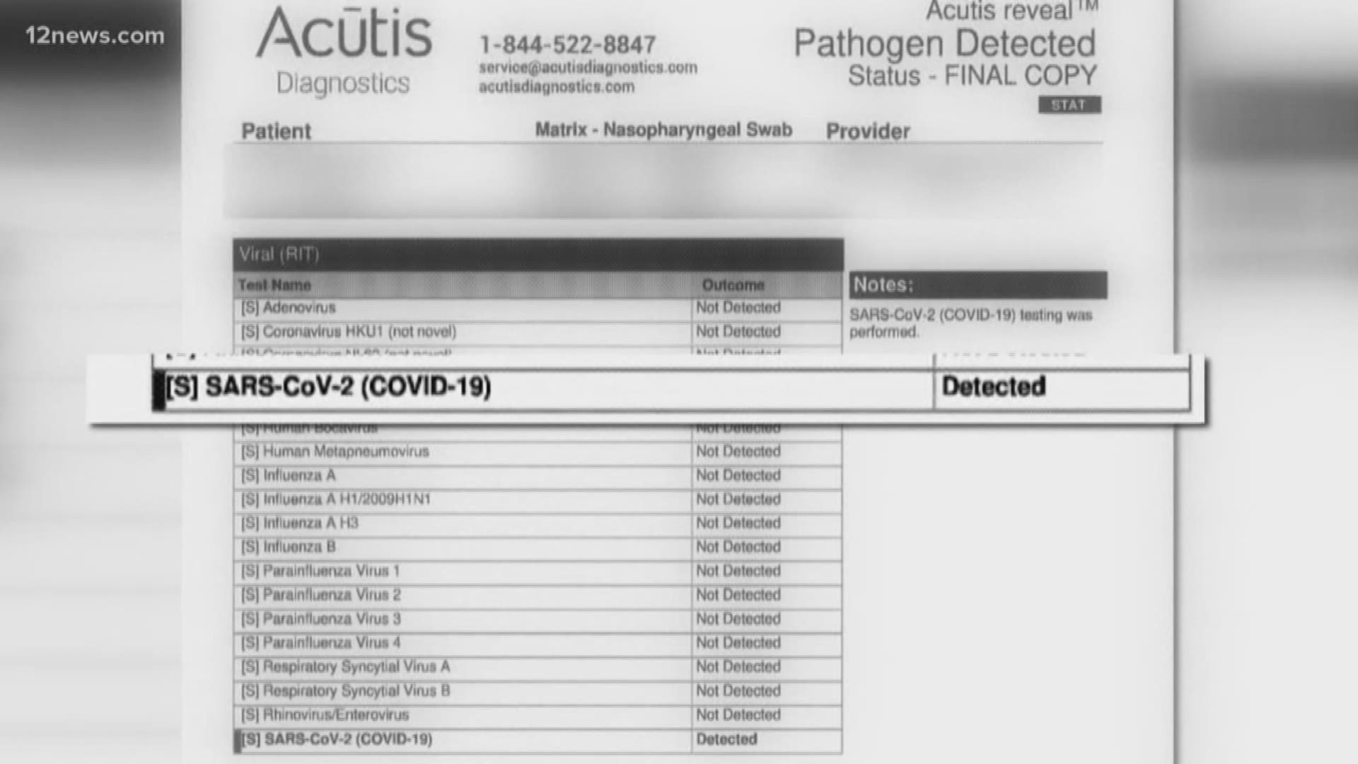 Doctor Sent Covid 19 Swab To Ny After Problems Getting Results 12news Com