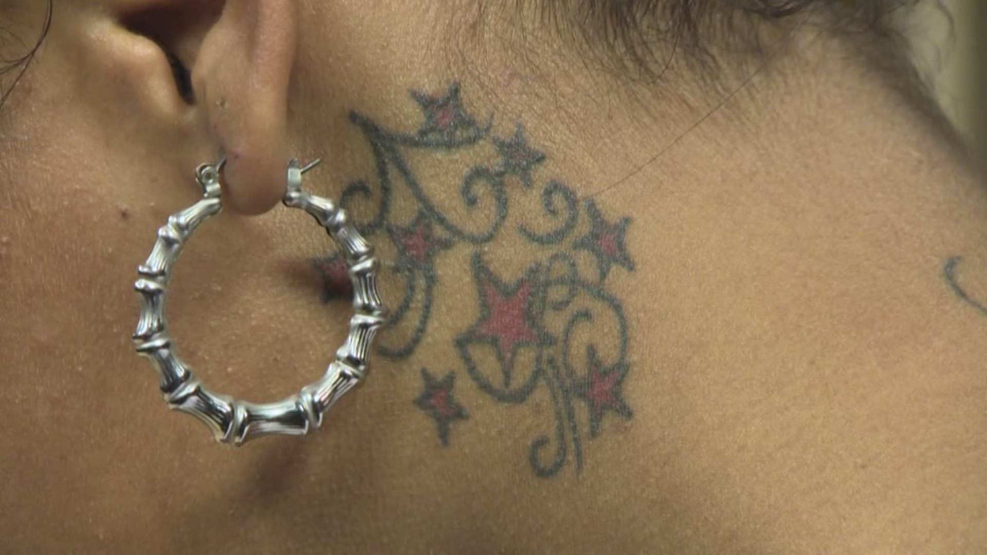 Consumer Reports looked into the best tattoo removal methods available.
