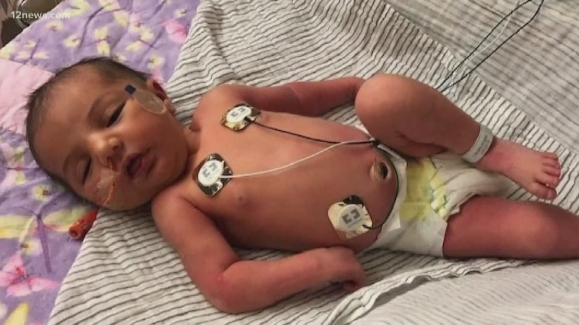 A Valley couple's six-month-old is suffering from a rare disorder which doctors have known about for less than a decade. The family says their daughter is the only case Phoenix Children's Hospital has ever seen.