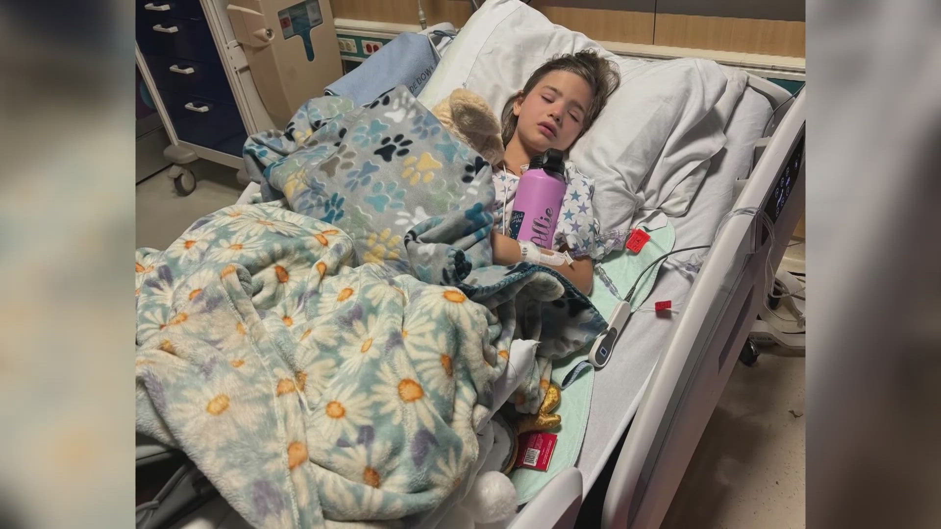 Doctors didn't know she had a rattlesnake bite until 24 hours after the bite happened.