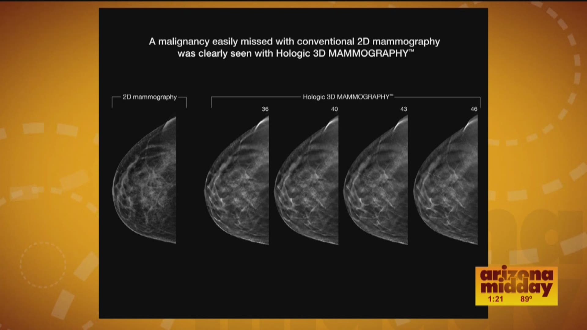 solis mammography skyline