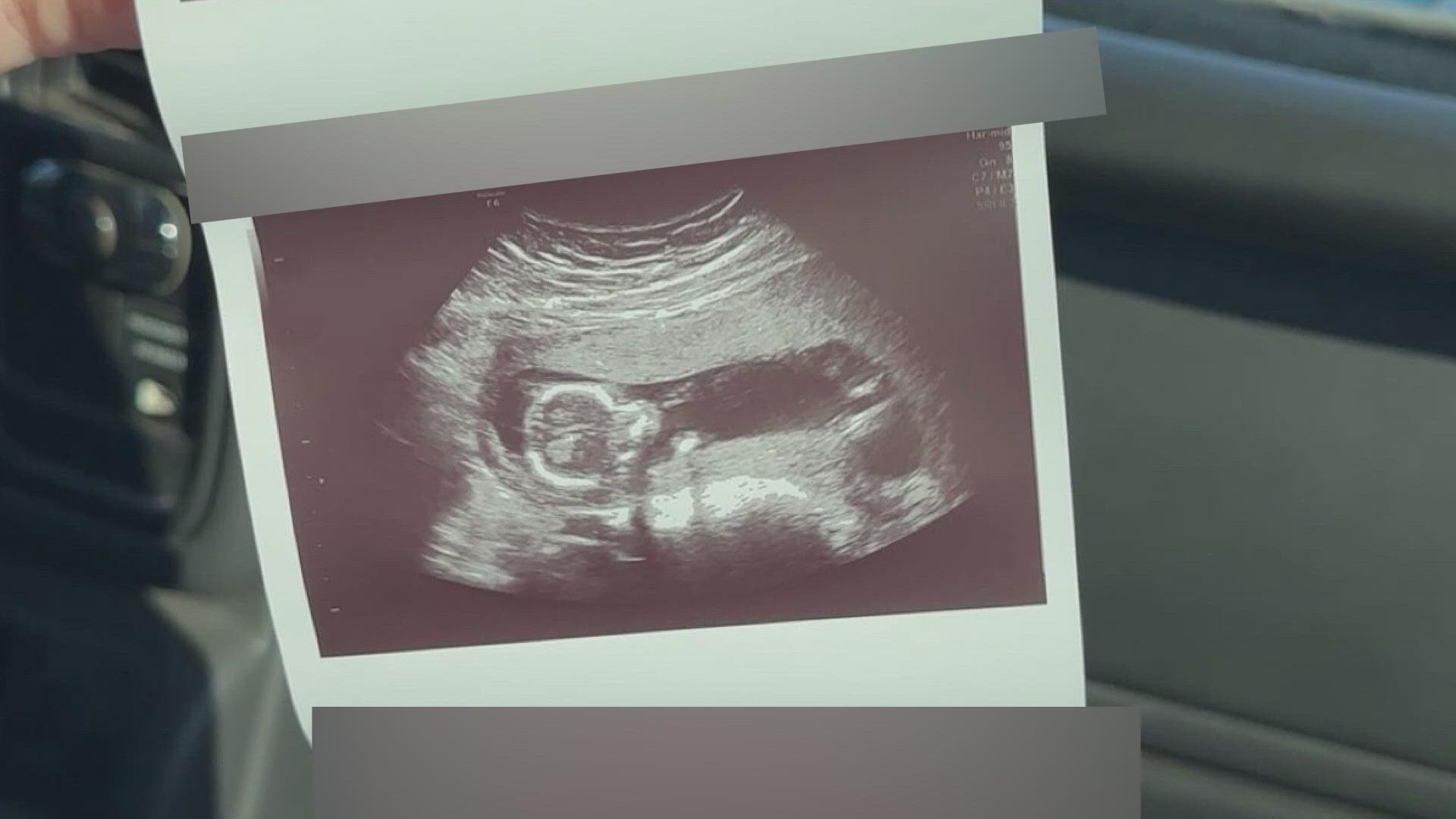 A newlywed found out she had cancer while expecting her first child.