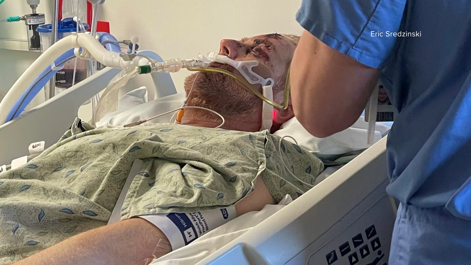 Miracle that I'm still here': Arizona cyclist credits blood donors