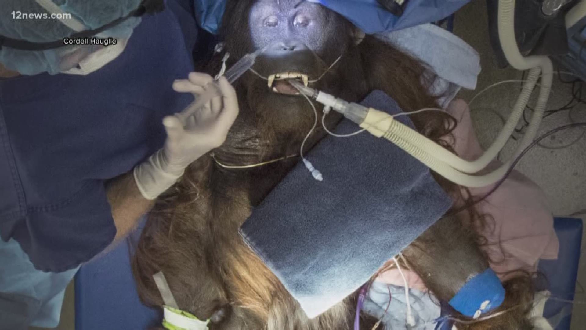 To save a beloved orangutan's life, zoo officials had to resort to a surgery that had never been performed in the U.S. -- done by a surgeon who's never worked on animals before.