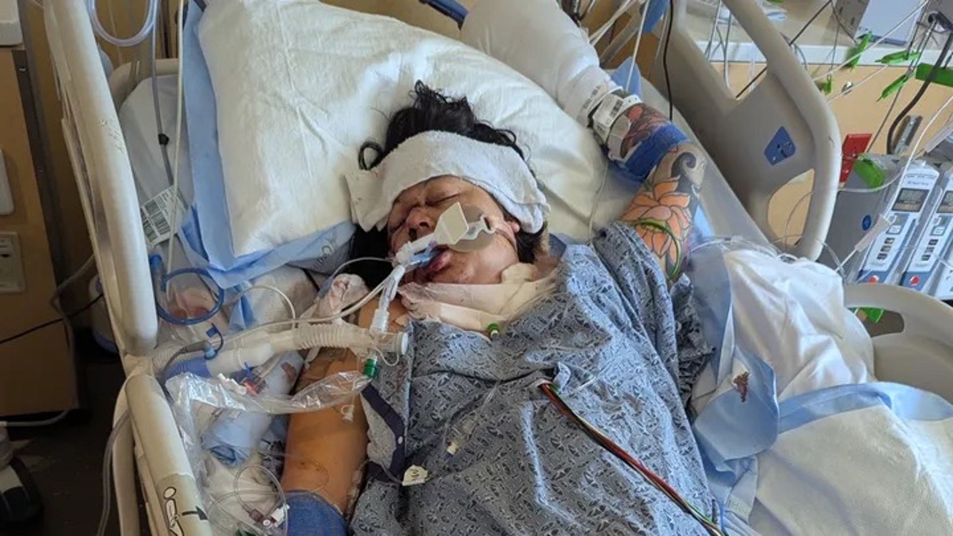 Erin Hume is recovering after being violently attacked by an alleged ex-boyfriend at home.