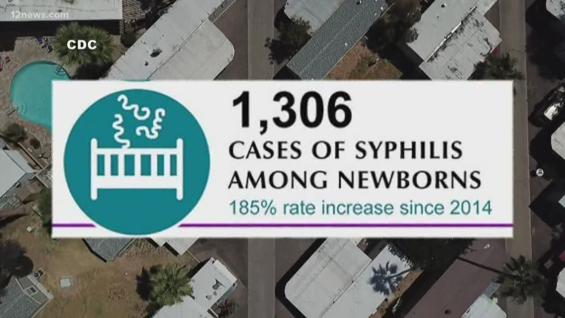 Babies Dying In Record Numbers From Congenital Syphilis | 12news.com