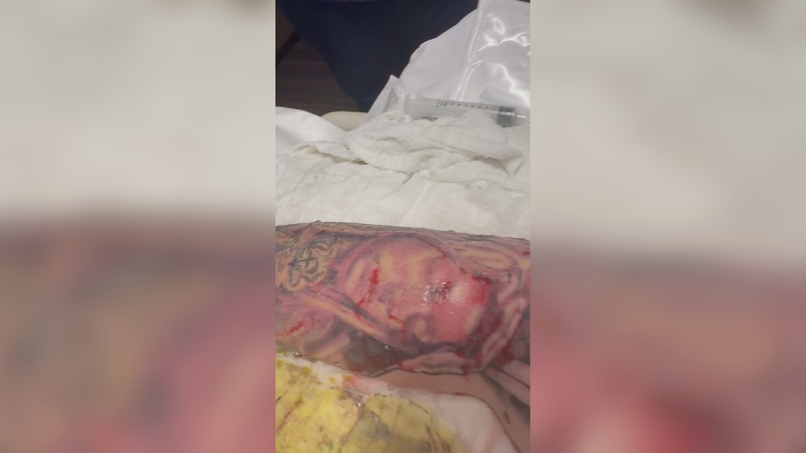 Phoenix woman says she was hospitalized after tattoo from artist found on social media