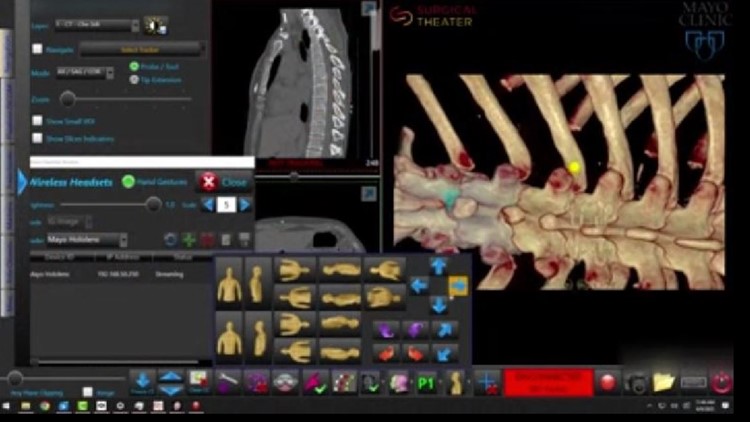 'It really levels everyone up': Mayo Clinic using augmented reality to help with brain and spine surgeries