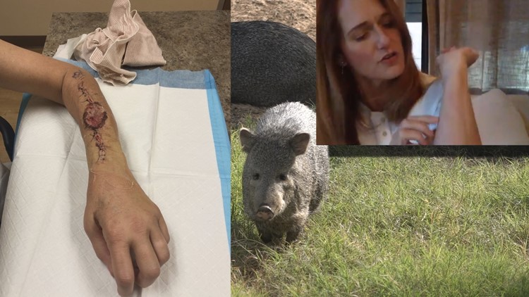 Javelina attack survivor gives advice to others 