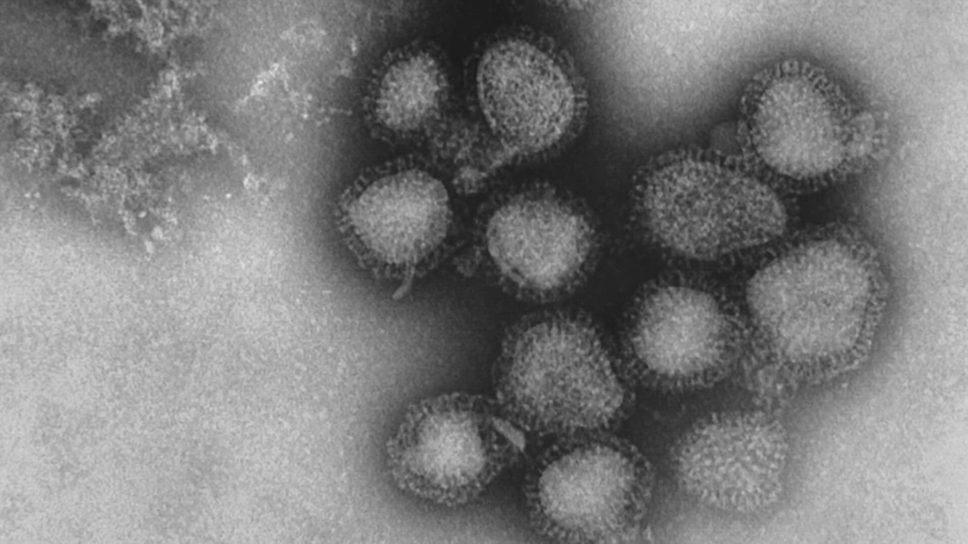 Concern over new flu variant dubbed 'Super Flu' | 12news.com