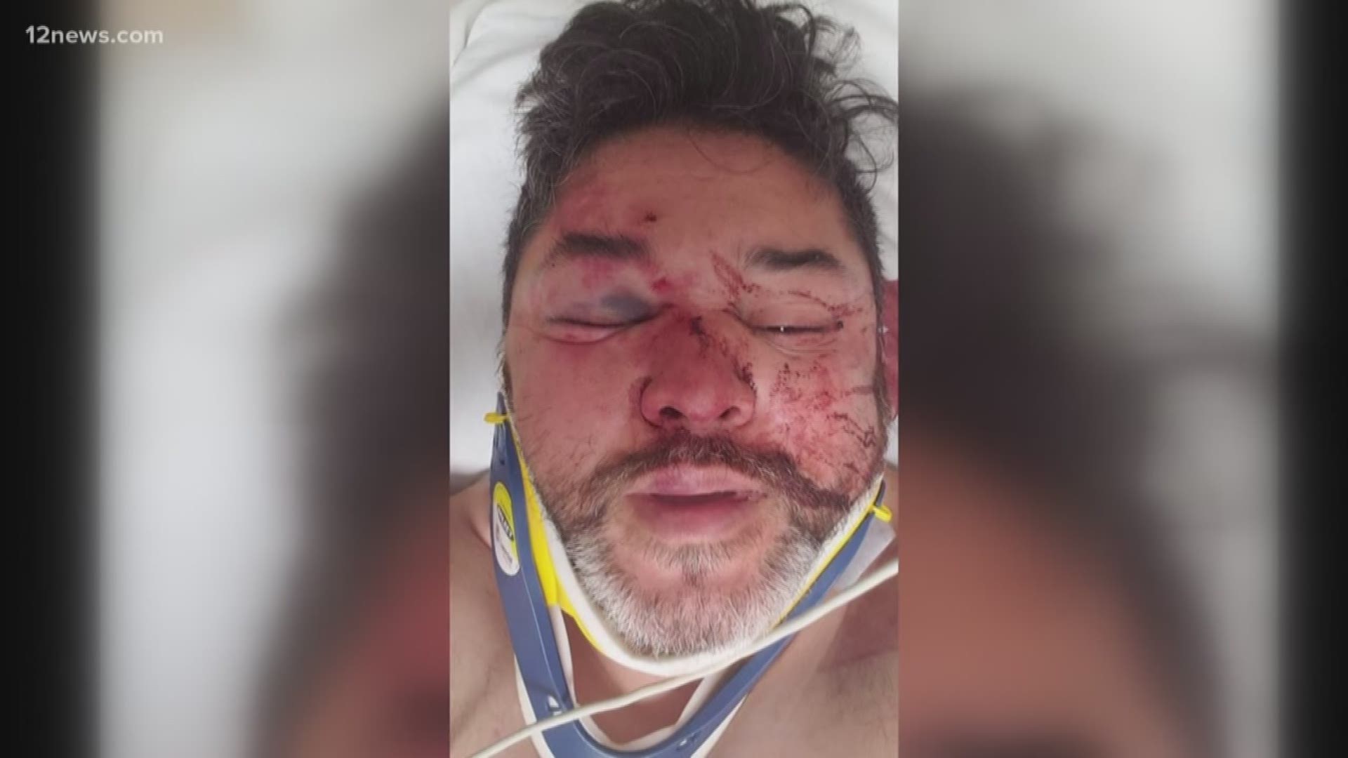 A Phoenix man said he was bashed because he's gay and then attacked by multiple people in downtown Phoenix. Police are investigating.