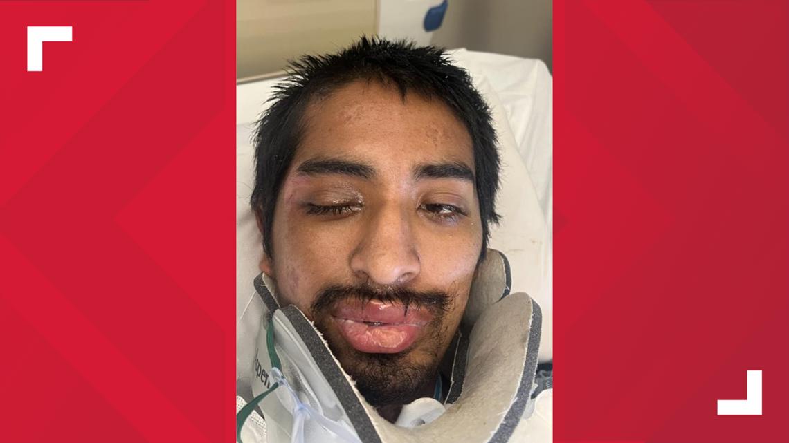Banner Health asks for public's help identifying patient hit by car in Phoenix