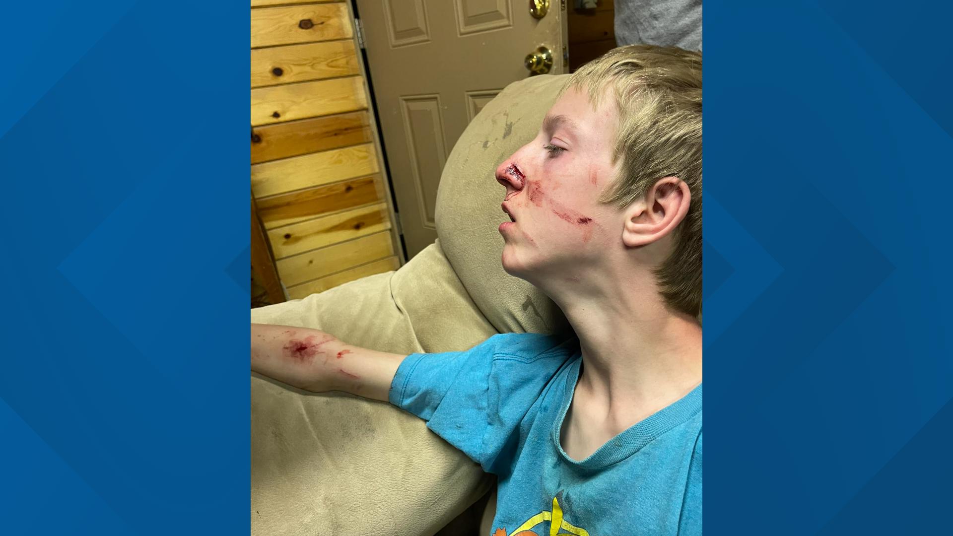 15-year-old Brigham Hawkins was watching TV when a bear walked inside and attacked him. 12News spoke to his mother about the incident on Saturday.