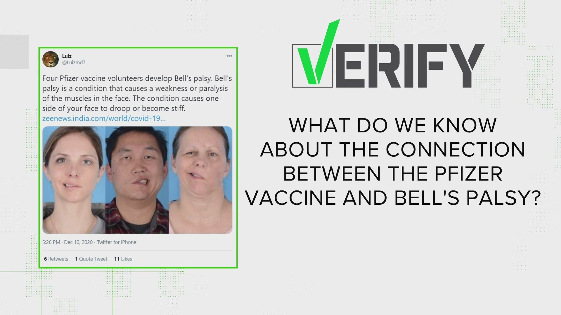 People are sharing a claim that four Pfizer vaccine volunteers developed Bell's Palsy during the trial. What's the connection between the vaccine and Bell's palsy?