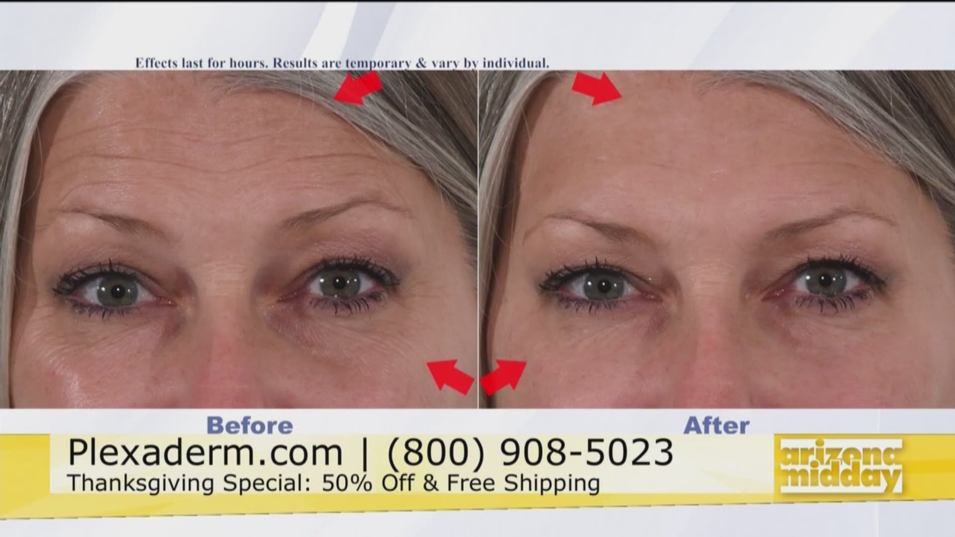 Look Younger In Minutes for the Holidays with Plexaderm
