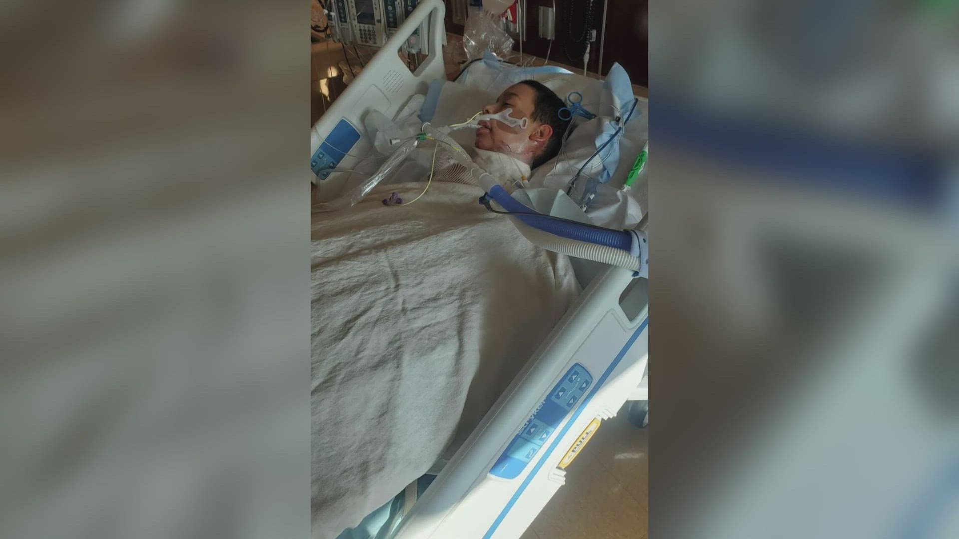 Tucson boy suffers severe burns after trying TikTok challenge