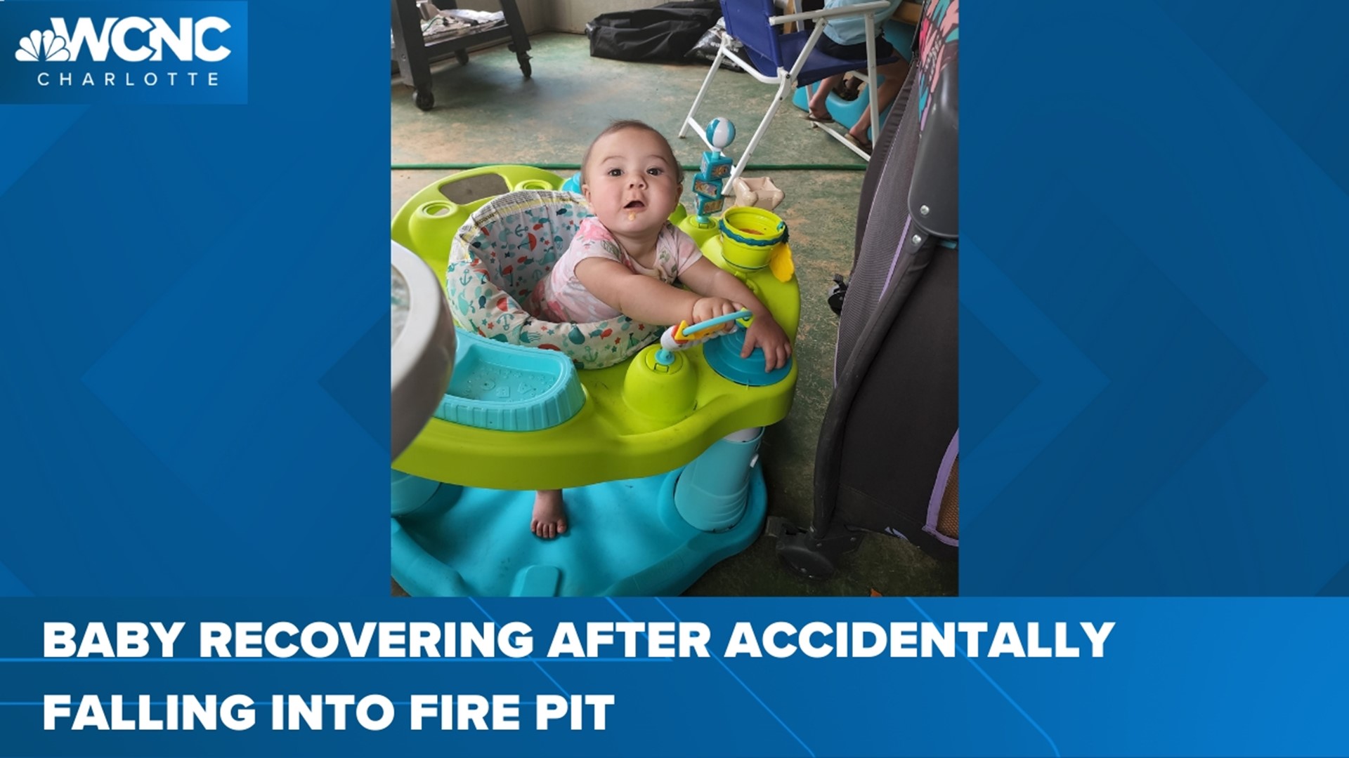 A 7-month-old baby girl is recovering in the hospital after falling into a fire pit and suffering second degree burns.